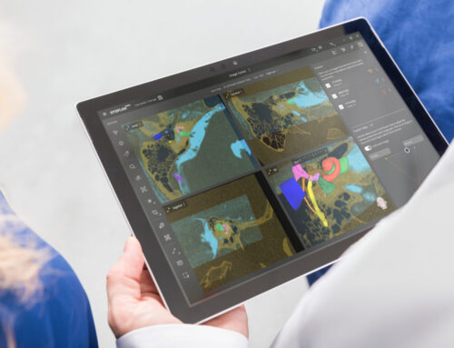 Včasná kochleárna implantácia je kľúčová!