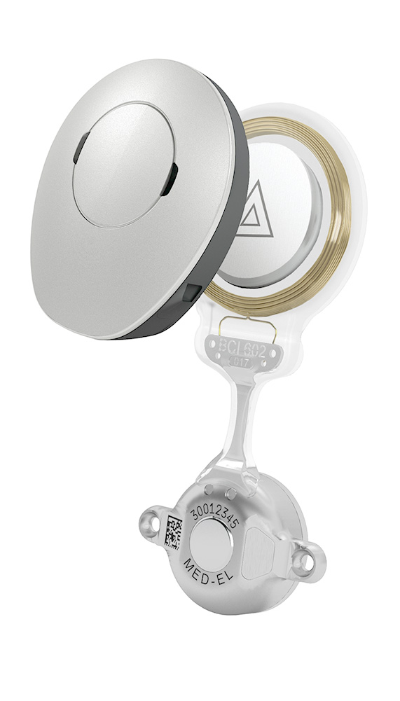 BONEBRIDGE BCI602 implant